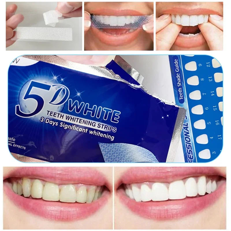 5 ابعاد لتبييض الاسنان